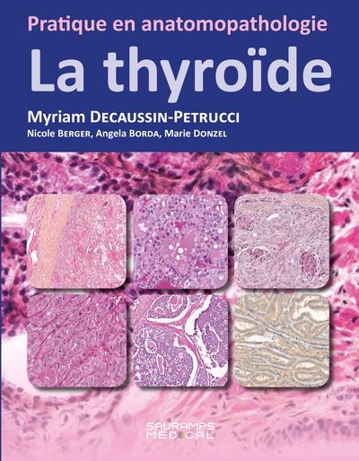 La thyroïde: Pratique en anatomopathologie