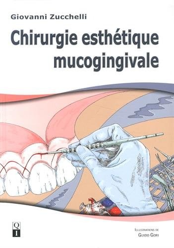 Chirurgie esthétique mucogingivale