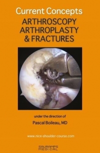 CURRENT CONCEPTS. ARTHROSCOPY, ARTHROPLASTY & FRACTURES