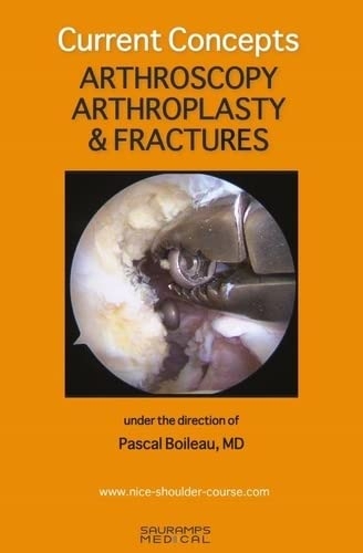 CURRENT CONCEPTS. ARTHROSCOPY, ARTHROPLASTY & FRACTURES