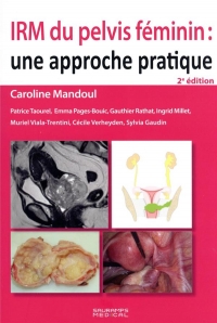 IRM du pelvis féminin 2e ED: Une approche pratique