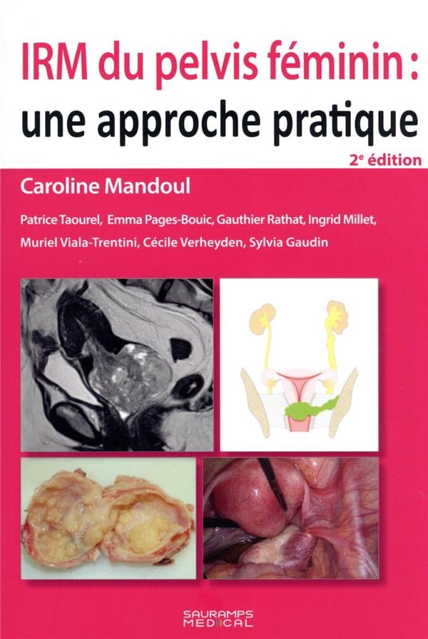 IRM du pelvis féminin 2e ED: Une approche pratique