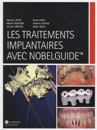 Les traitements implantaires avec Nobelguide