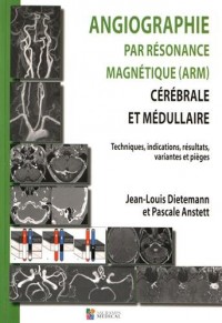 Angiographie par résonance magnétique (ARM) cérébrale et médullaire : Techniques, indications, résultats, variantes et pièges