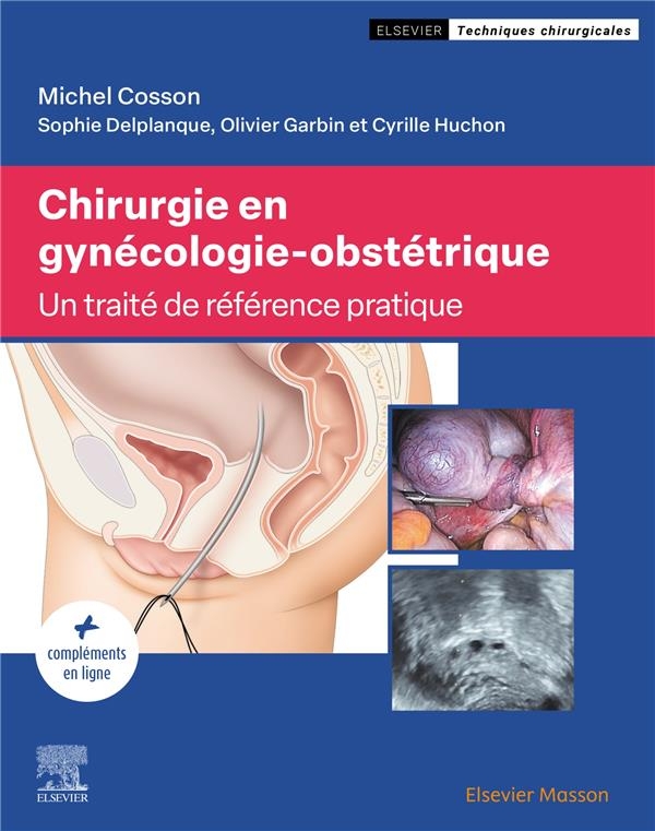 Chirurgie en gynécologie-obstétrique: Traité de référence pratique