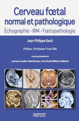 Cerveau foetal normal et pathologique -Echographie, IRM, Foetopathologie