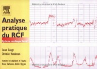 Analyse pratique du RCF : Rythme cardiaque foetal