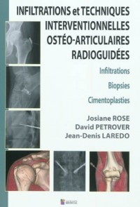 Infiltrations et Techniques Interventionnelles ostéo-articulaires radioguidées : Infiltrations, Biopsies, Cimentoplasties