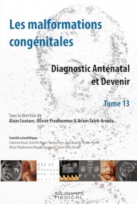 Les malformations congénitales - Diagnoctic Anténatal et Devenir T 13: Les malformations congénitales T 13