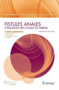 Fistules anales: utilisation des colles de fibrine