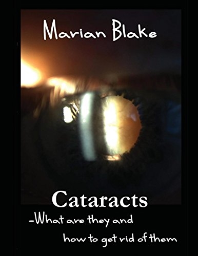 Cataracts: What are they and how to get rid of them?