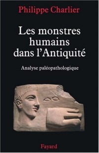 Les monstres humains dans l'Antiquité : Analyse paléopathologique