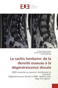 Le rachis lombaire: de la densité osseuse à la dégénérescence discale: DMO mesurée au scanner: distribution et variation Dégénérescence discale à l'IRM: relation avec l'âge et le genre