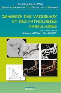 Imagerie des vaisseaux et des pathologies vasculaires