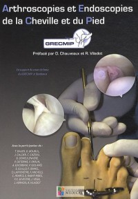 Arthroscopies et endoscopies de la cheville et du pied