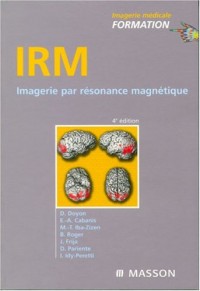 IRM : Imagerie par résonance magnétique