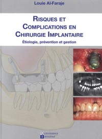 Risques et complications en chirurgie implantaire : Etiologie, prévention et gestion