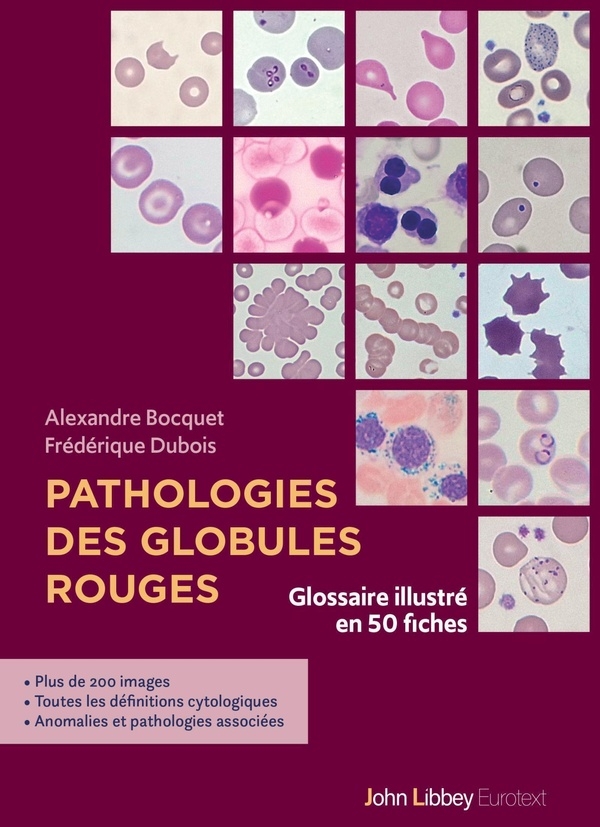 Pathologies des globules rouges: Glossaire illustré en 50 fiches