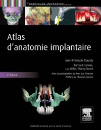 Atlas d'anatomie implantaire: Pilon Partiel 400ex 19/12/14