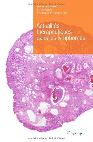 Actualités thérapeutiques dans les lymphomes