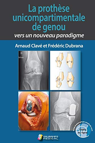 La prothèse unicompartimentale de genou : vers un nouveau paradigme